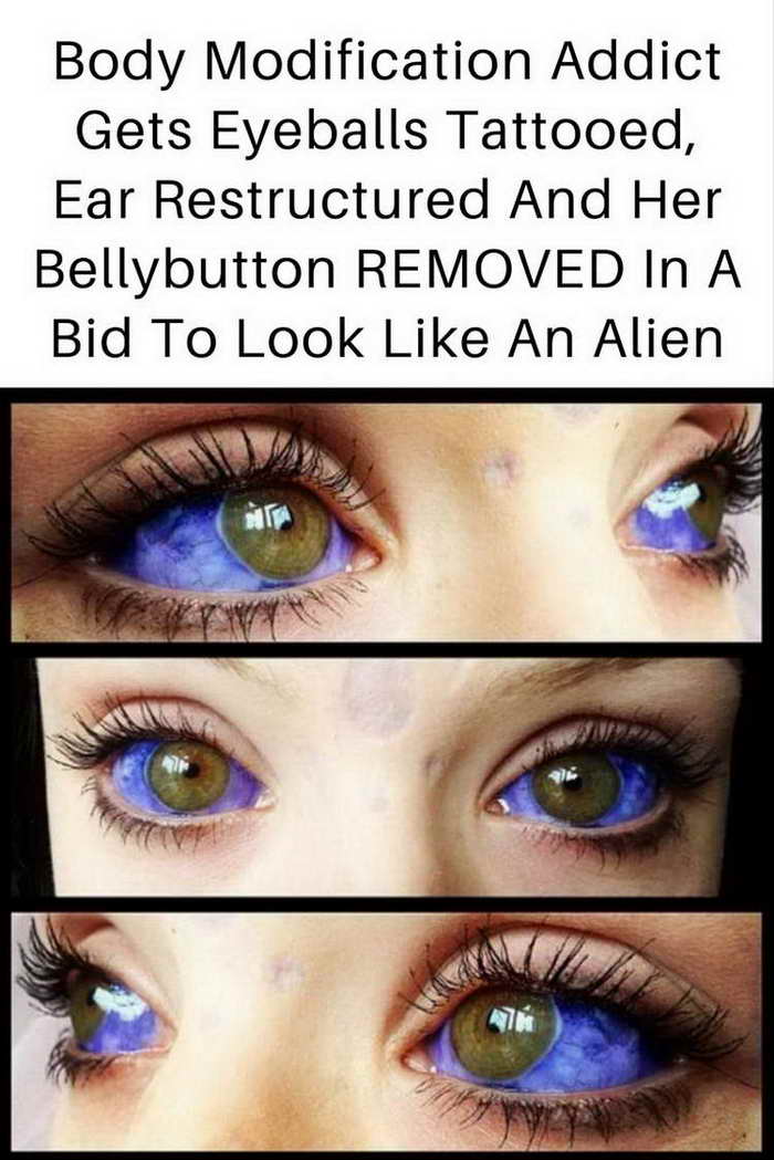 Body Modification Addict Gets Eyeballs Tattooed, Ear Restructured And