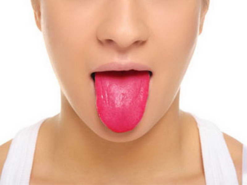 How Your Tongue Tells You About Your Health